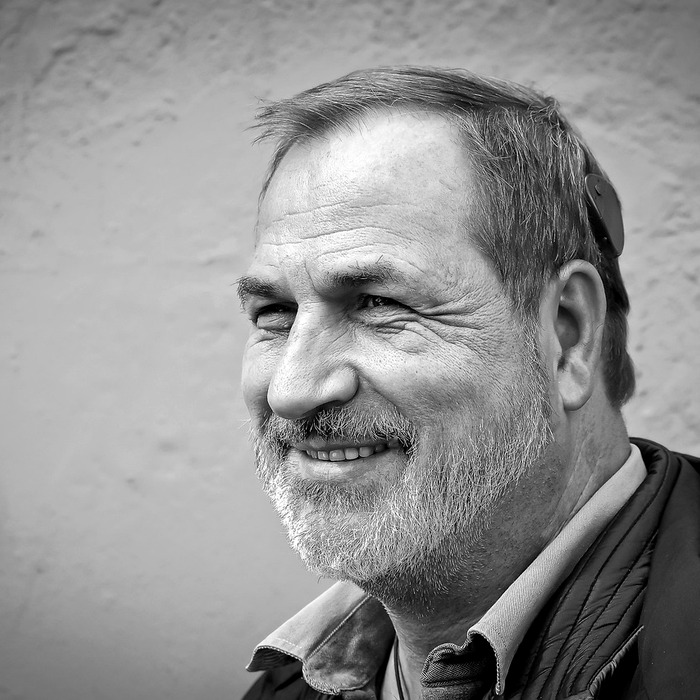 임플란트 치료 과정