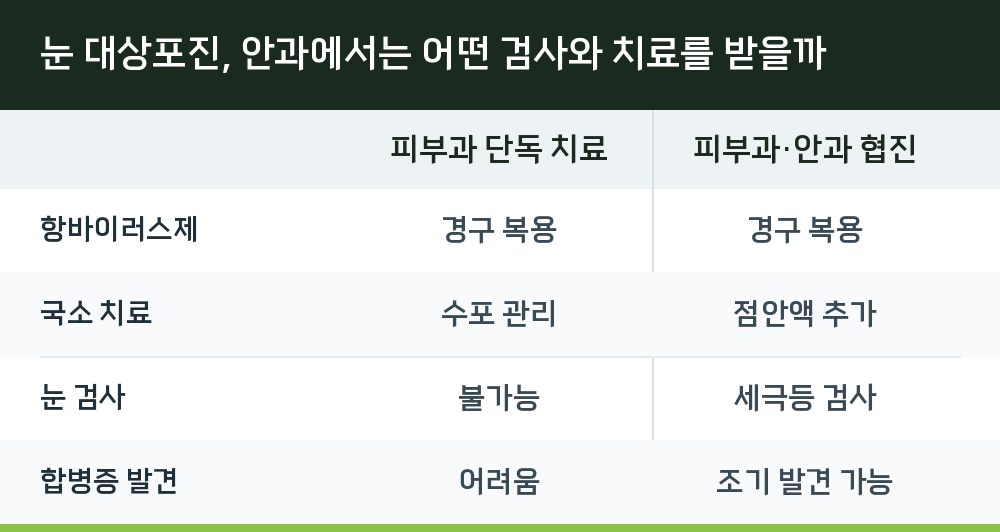 눈 대상포진, 안과에서는 어떤 검사와 치료를 받을까